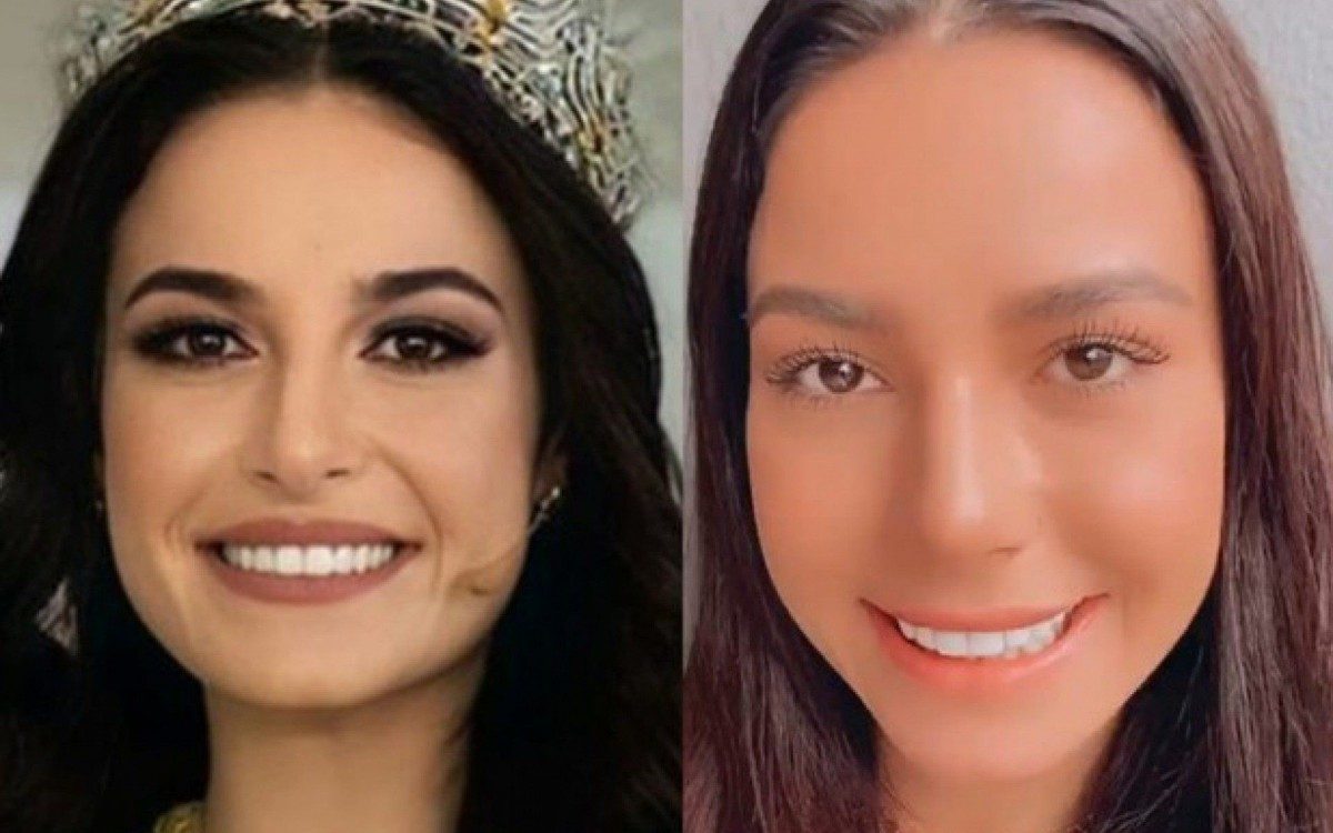 Miss Brasil 2020, Julia Gama faz procedimento no nariz - reprodução do instagram