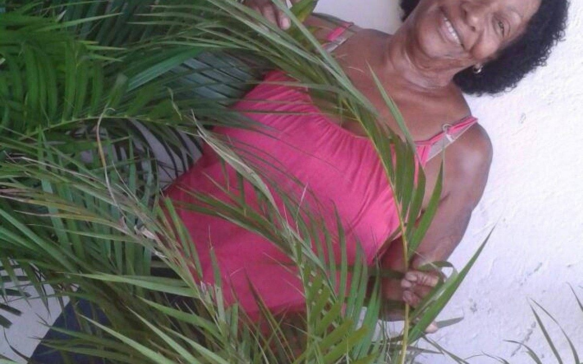 Maria Jos&eacute; de Oliveira Pedroza, uma das v&iacute;timas graves do inc&ecirc;ndio, sofreu queimaduras de terceiro grau em 90% do corpo quando tinha apenas 11 anos e carrega marcas at&eacute; hoje