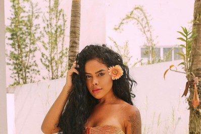 Influencer revela drama após uma rinoplastia: 'Virei um pinóquio'