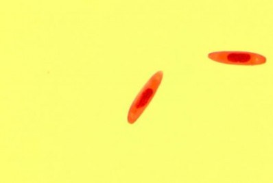 Pesquisadores descobrem fungos que transformam moscas em 'zumbis'