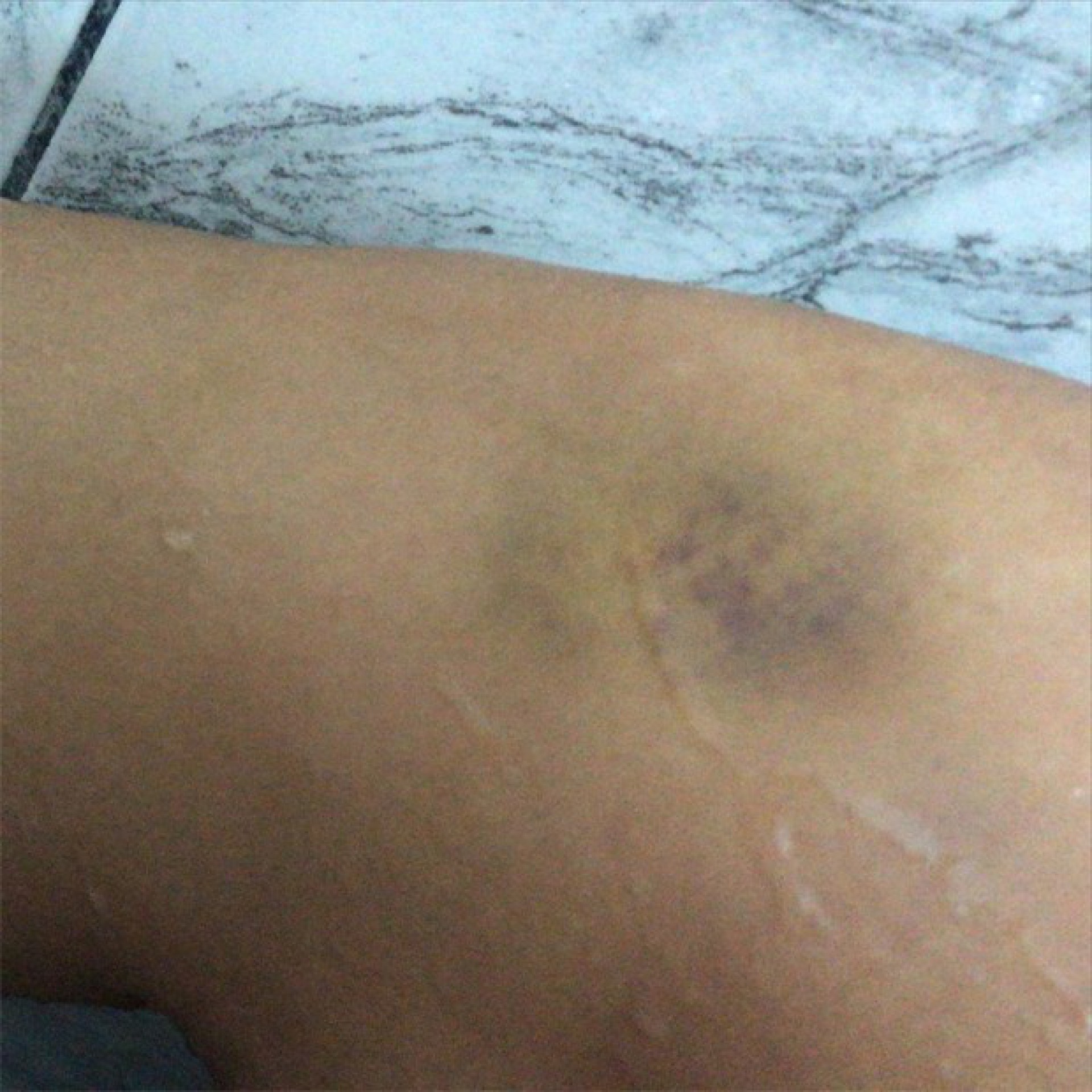 Ex-namorada de Darlan Cunha, o Laranjinha, o acusa de agressão nas redes sociais - Reprodução Internet