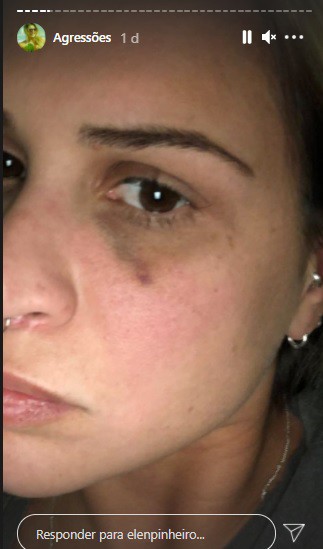 Elen Pinheiro mostra as agressões - Reprodução