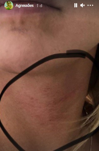 Elen Pinheiro mostra as agressões - Reprodução