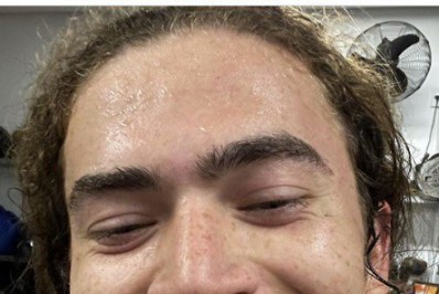 Whindersson Nunes quebra o dente durante treino de luta