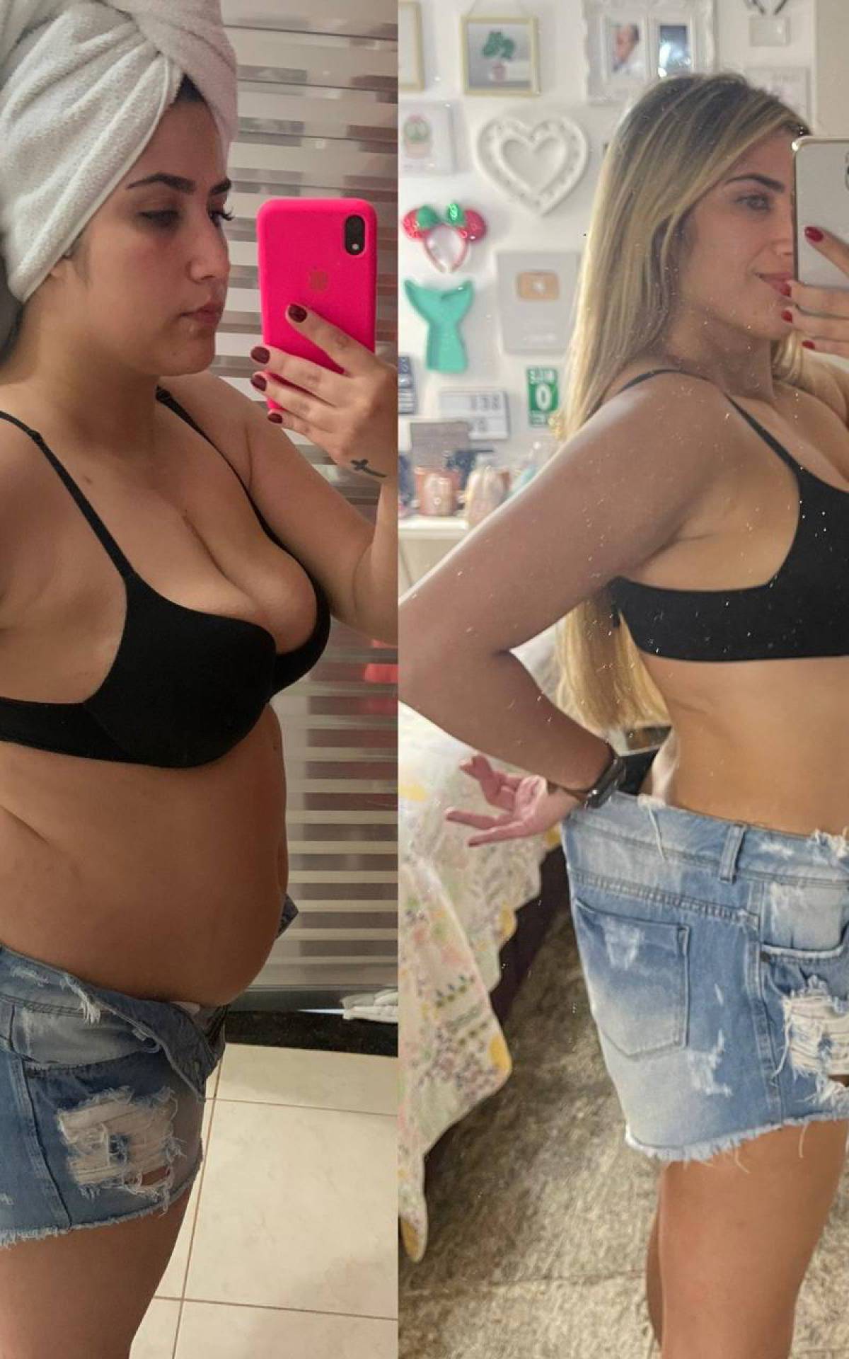 Jessica Costa perdeu mais de 20 kg ap&oacute;s passar por cirurgia 