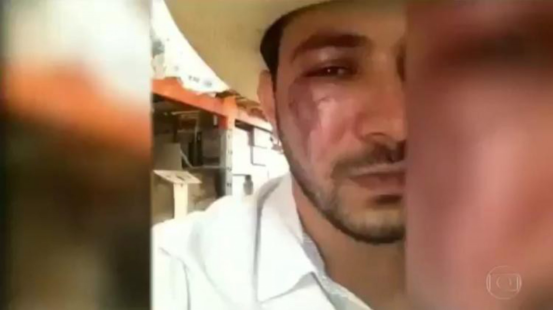 Caio foi agredido e apareceu no 'Globo Rural' - Reprodução