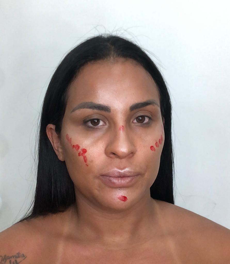 3 - Onde aplicar: usar nas olheiras em caso de manchas escuras ou roxas. - Divulgação