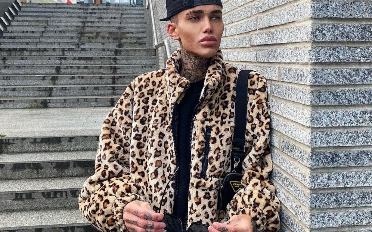 Rapaz gasta R$ 230 mil com plásticas para ficar parecido com filtro do Instagram