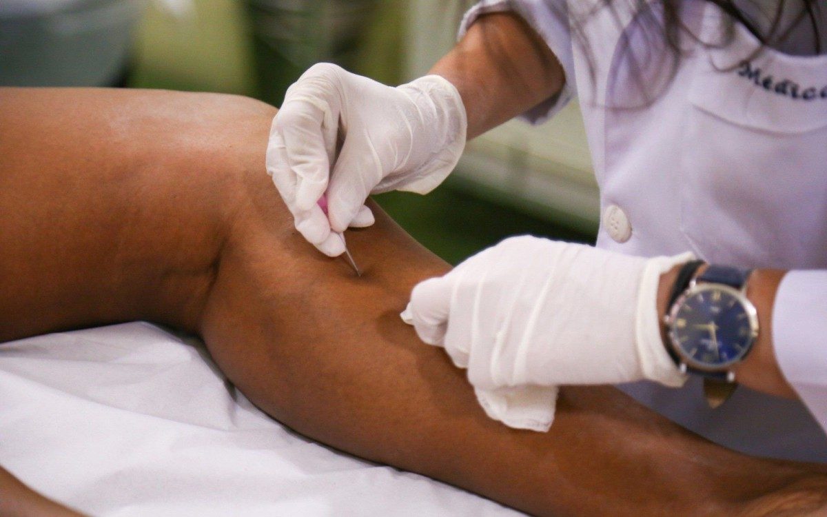 Tratamento de varizes gratuito na Sa&uacute;de de Mesquita