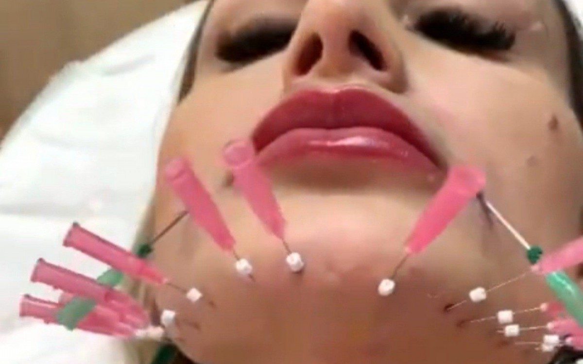 Andressa Urach