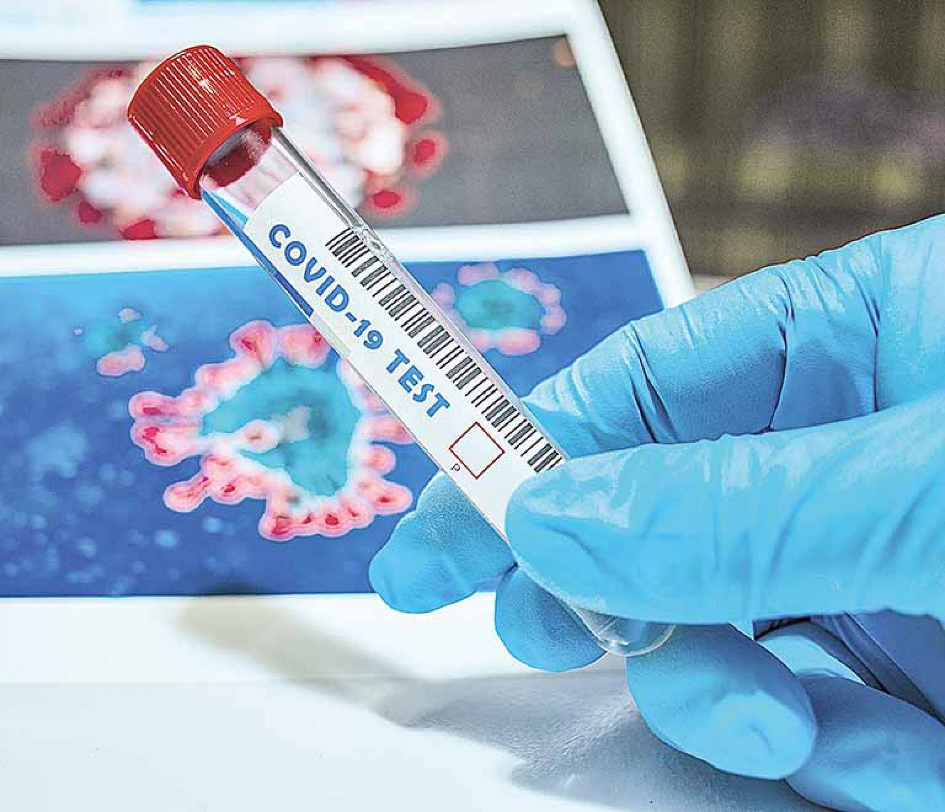 Pre&ccedil;o alto deve fazer coquetel contra Covid-19 dificilmente chegar ao SUS, diz infectologista