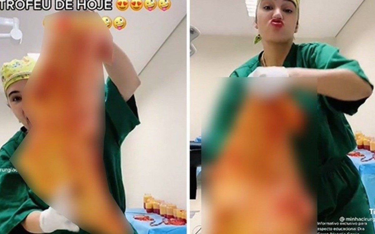 A cirurgi&atilde; Caren Trisoglio Garcia postou v&iacute;deos de pele de pacientes nas redes sociais
