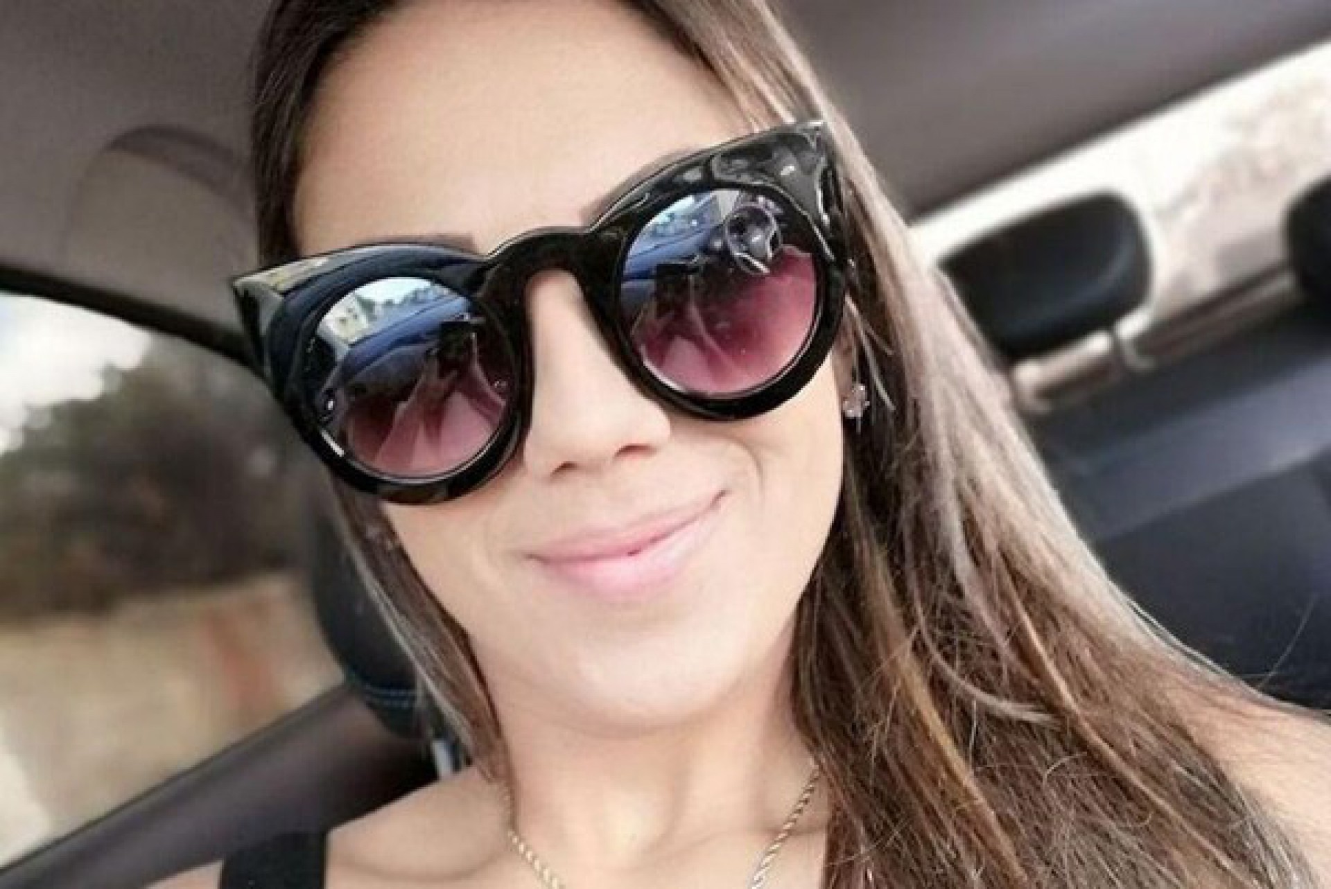 Após cirurgia plástica, jovem de 27 anos sofre parada cardíaca e morre