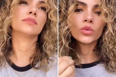 kelly key faz alerta sobre a prevenção do câncer de pele 