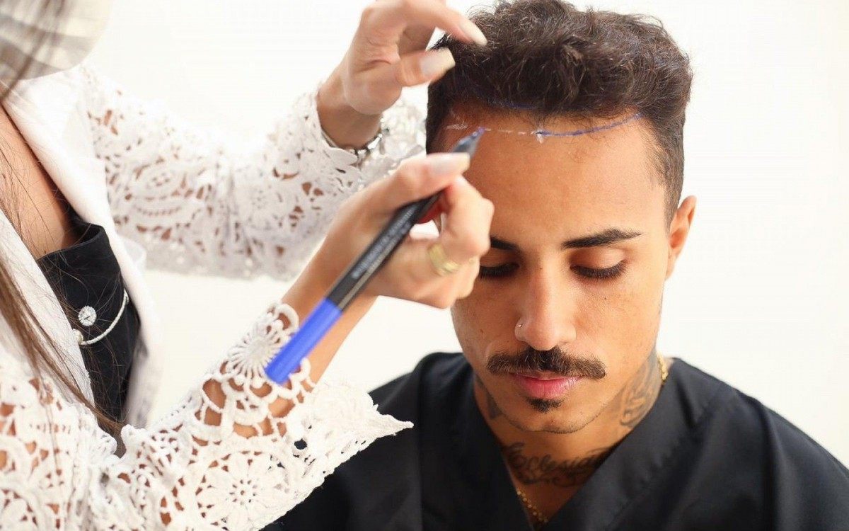 MC Livinho explica motivo que o levou a fazer implante capilar