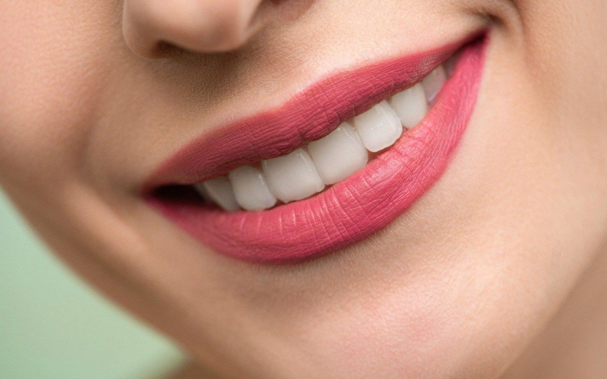Mitos e verdades sobre clareamento dental - Divulgação