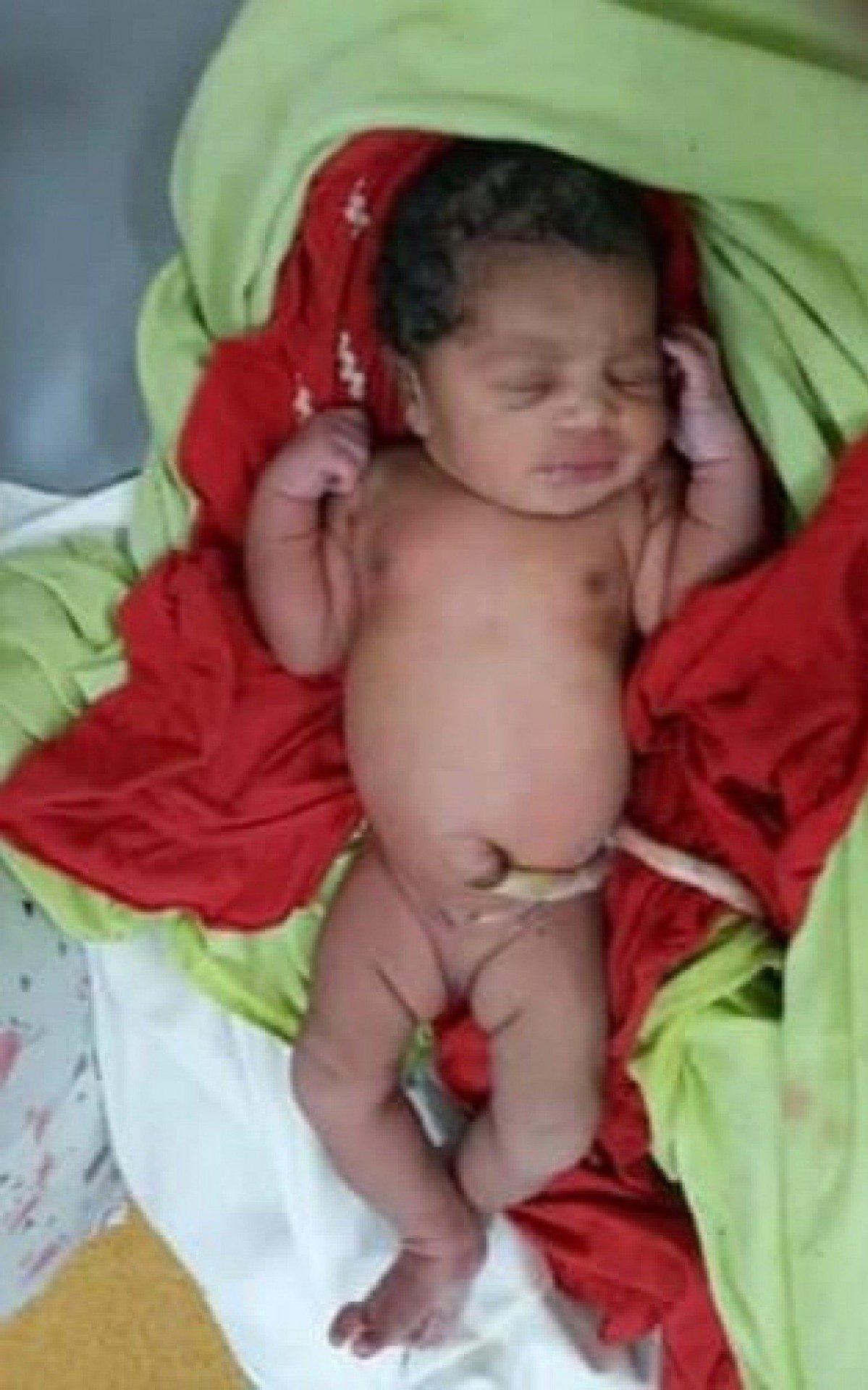 A menina, hoje com uma semana de vida, foi deixada ainda com o cord&atilde;o umbilical na manh&atilde; da &uacute;ltima ter&ccedil;a-feira (27) no estacionamento do Hospital Municipal Dr. Luiz Palmier