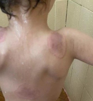 Criança de 3 anos é encontrada com marcas de agressão pelo corpo  - Divulgação