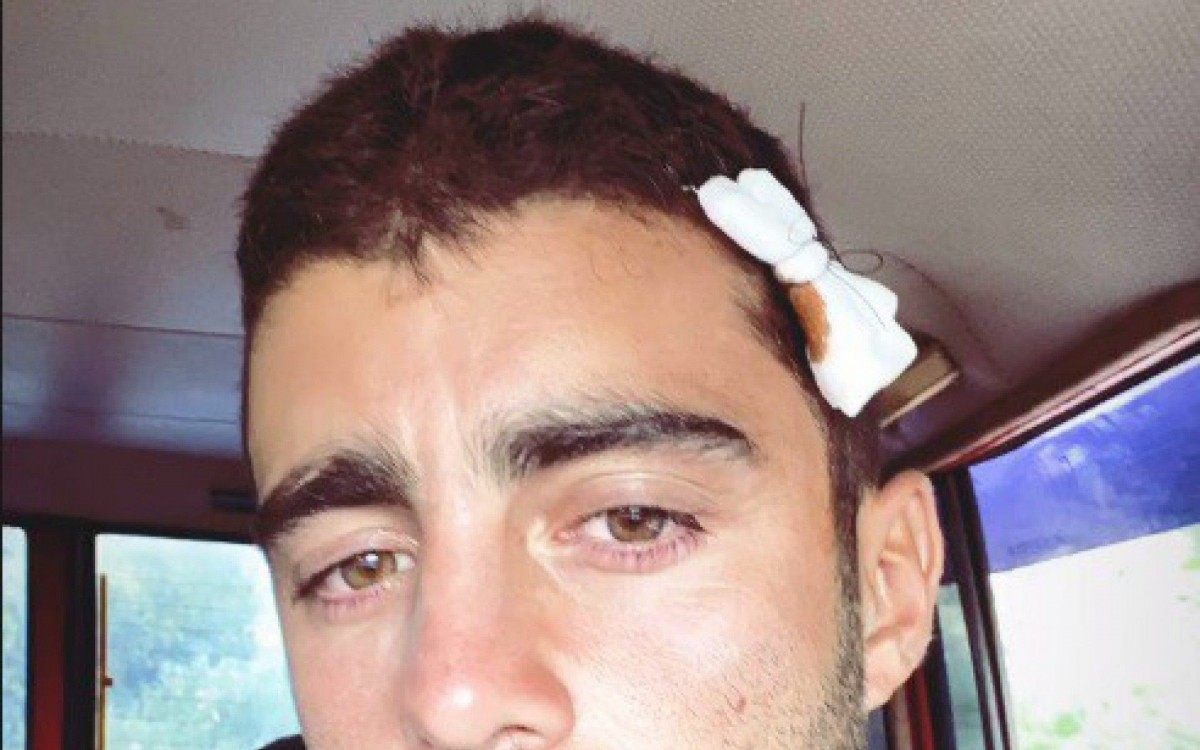 Pedro Scooby leva pontos na cabeça após acidente