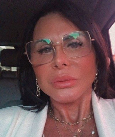 Gretchen mostra resultado do lifting facial feito recentemente
- Reprodução Internet