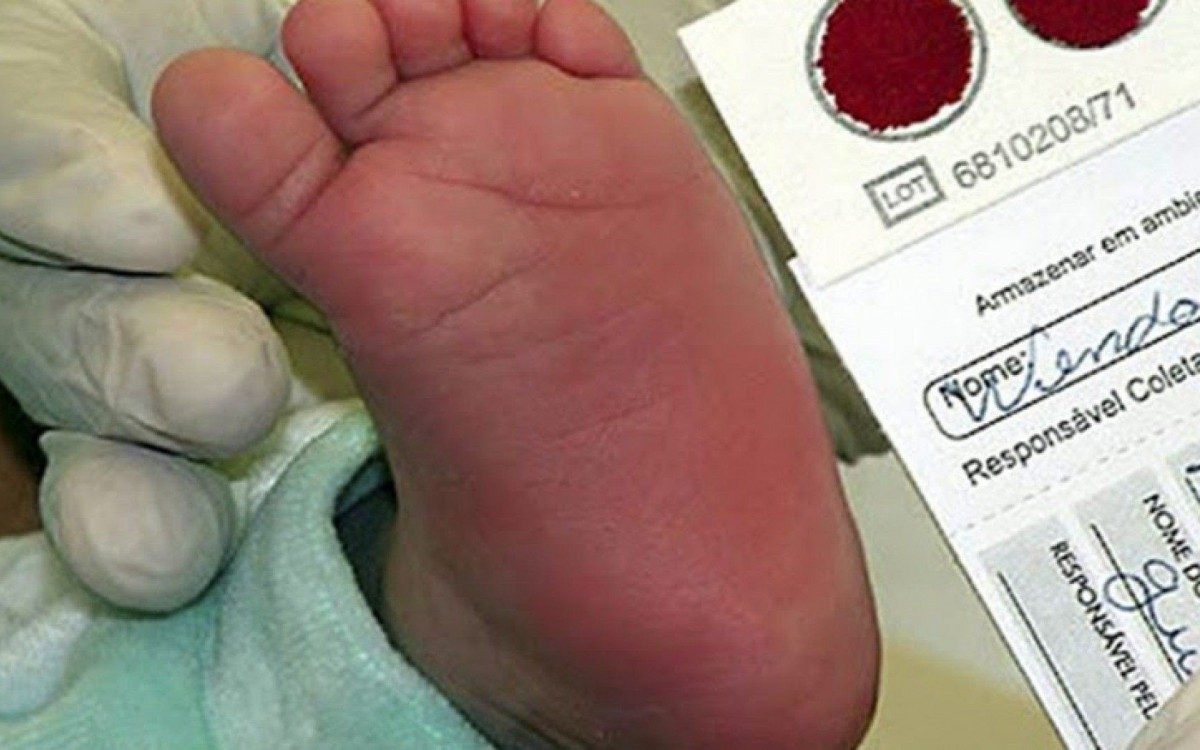 Unidades de sa&uacute;de poder&atilde;o ser obrigadas a fazer exame para detectar anemia falciforme em rec&eacute;m-nascidos