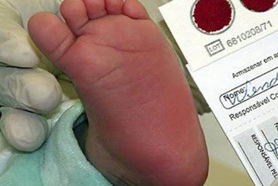 Unidades de saúde podem ser obrigadas a fazer exame para detectar anemia falciforme em recém-nascidos