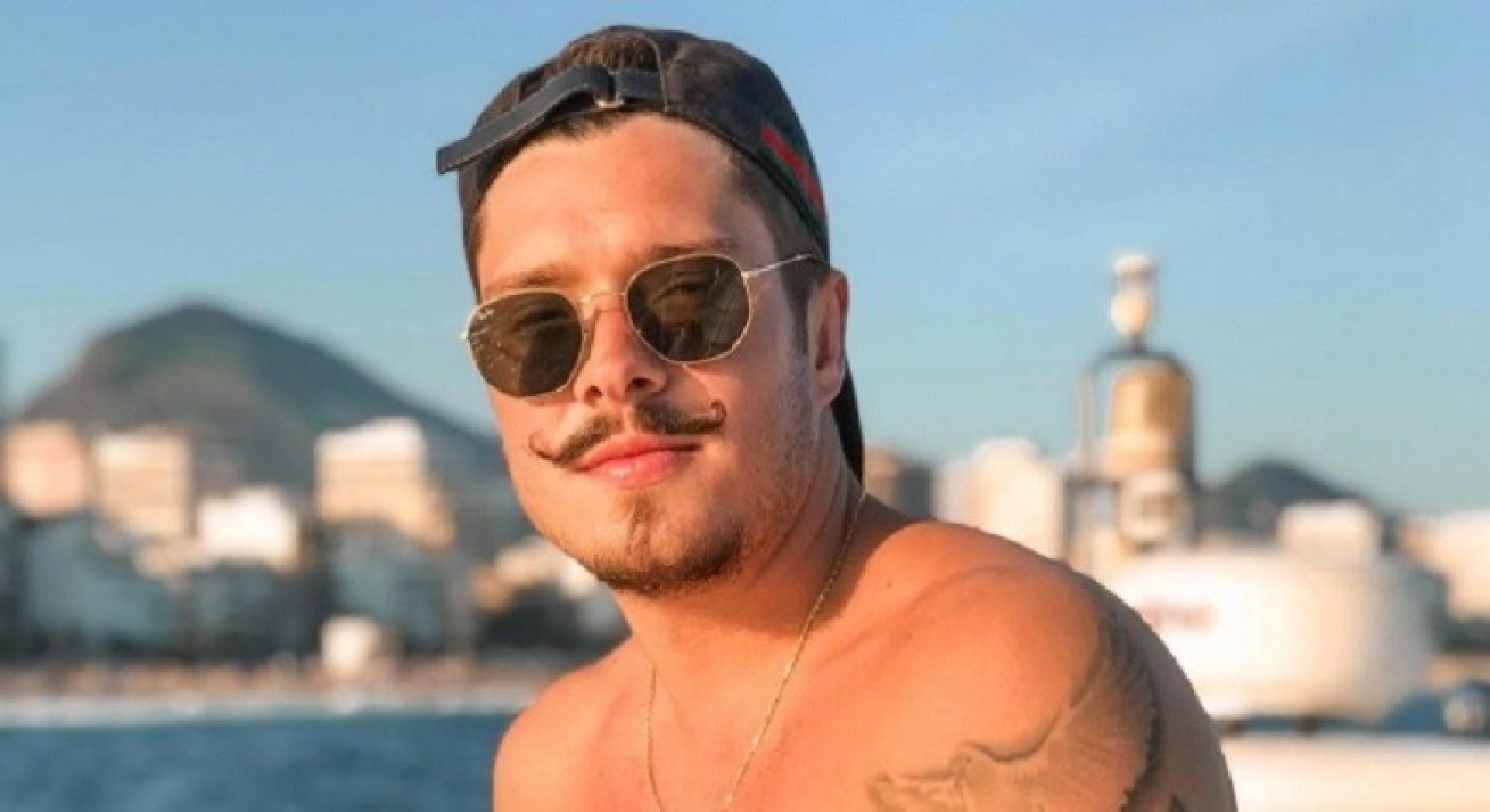 Ronan Souza coloca lentes nos dentes - Reprodução