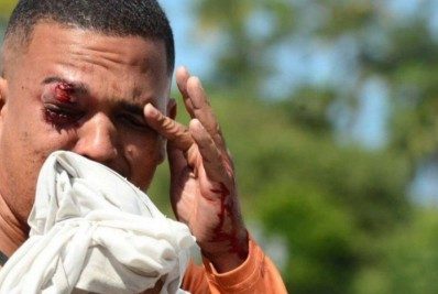 PM afasta militar que acertou tiro no olho de manifestante no Recife