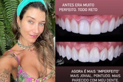Como assim? Gabriela Pugliesi faz procedimento para dentes parecerem 'imperfeitos'