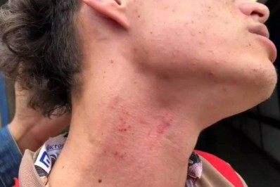 Artista de rua é imobilizado com 'mata-leão' no metrô 