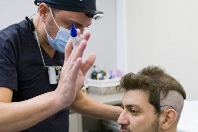 Ex-BBB Caio Afiune passa por transplante capilar 