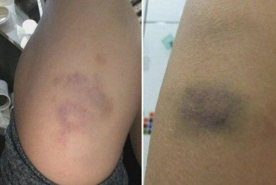 Adolescente de 16 anos é denunciado suspeito de agredir namorada e estuprar cunhada de 13 anos em Goiás