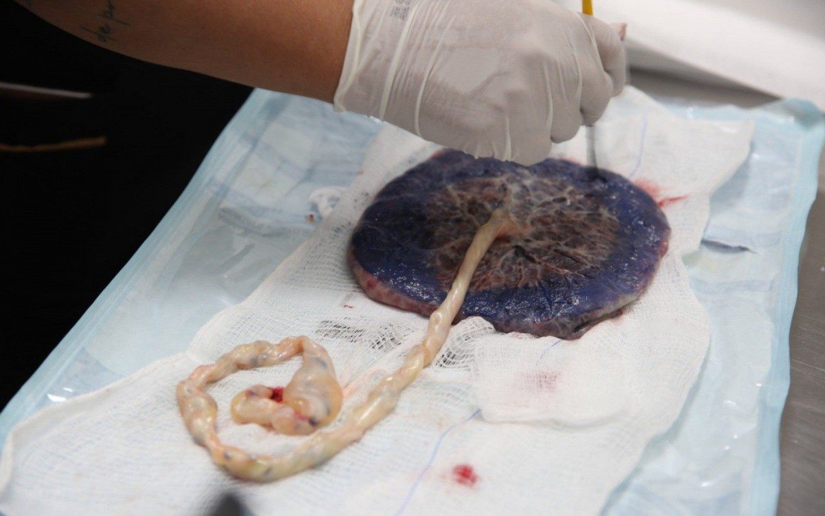 Maternidade de Santa Cruz da Serra completa um ano com 24 mil atendimentos - Eliakin Moura/Divulga&ccedil;&atilde;o