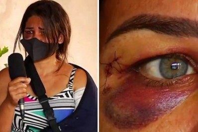 Funcionária de padaria é agredida e tem braço quebrado após pedir para cliente usar máscara 