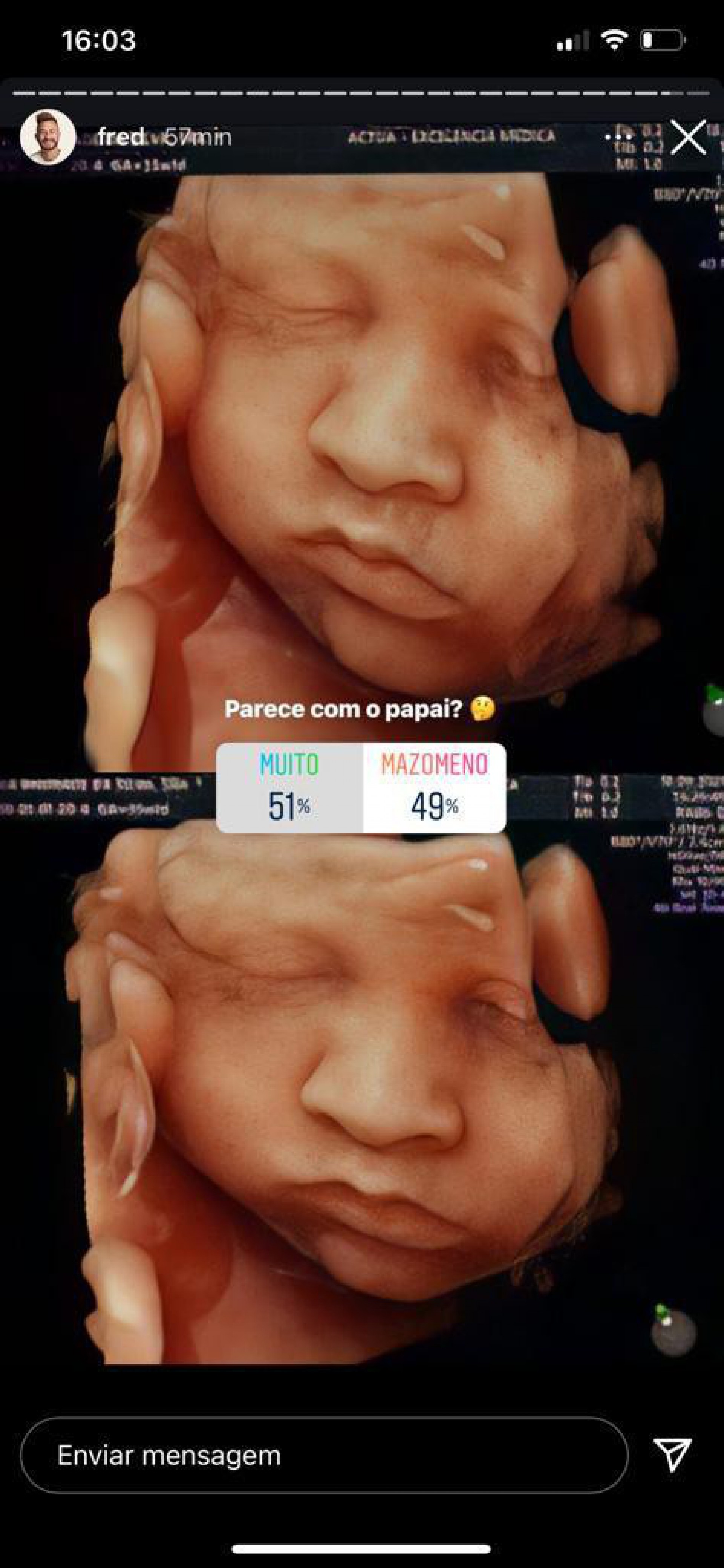 Youtuber Fred mostra o rosto do filho com Bianca Andrade em ultrassom 