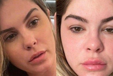 Bárbara Evans mostra rosto inchado devido a tratamento para engravidar