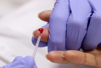 Guapimirim terá mutirão de testes rápidos de hepatites B e C, no dia 28 de julho