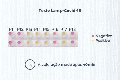 UFRJ desenvolve teste que identifica coronavírus em menos de uma hora