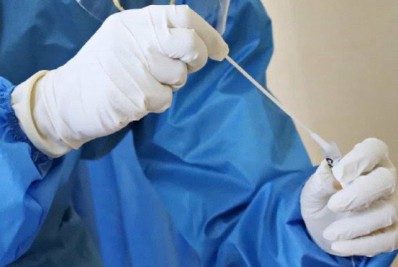 Covid-19: pesquisadores da UFSCar desenvolvem teste através da saliva e utilização de luz