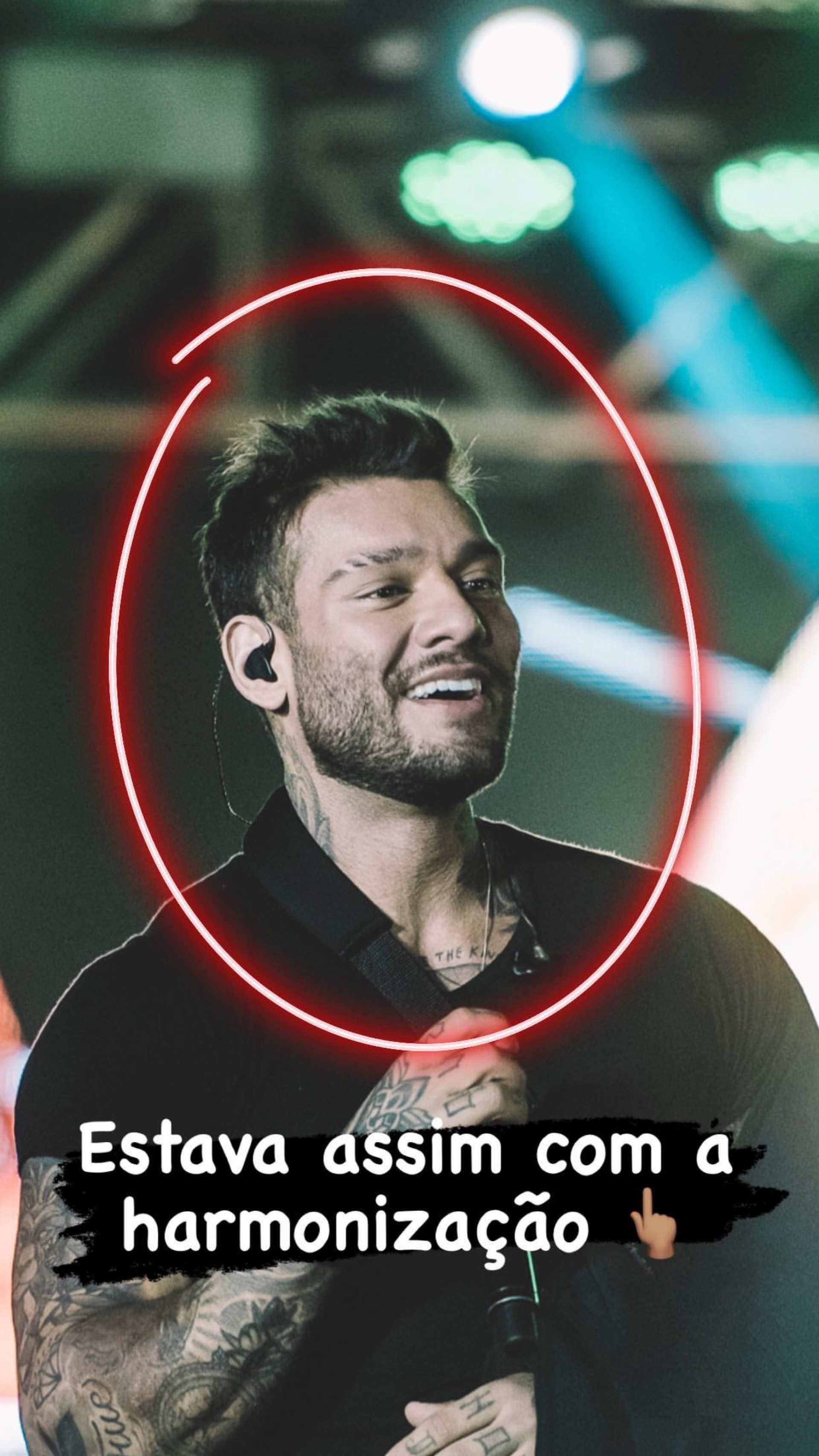 Lucas Lucco com harmonização facial - Reprodução/Instagram