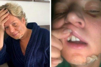 Marido de Joice Hasselmann nega agressão a mulher: 'jamais faria isso'