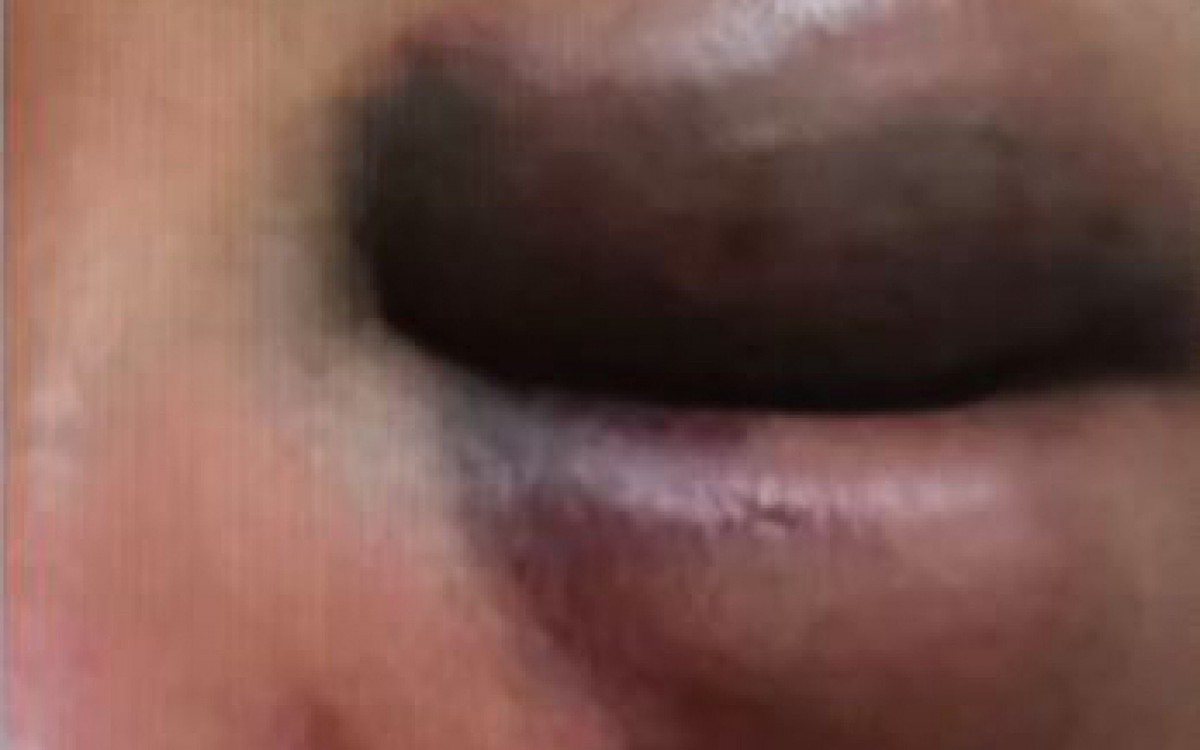 Lutador de artes marciais é preso por suspeita de agredir ex-namorada