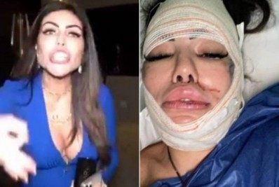 Mulher que atacou policiais em festa clandestina faz cirurgia de emergência