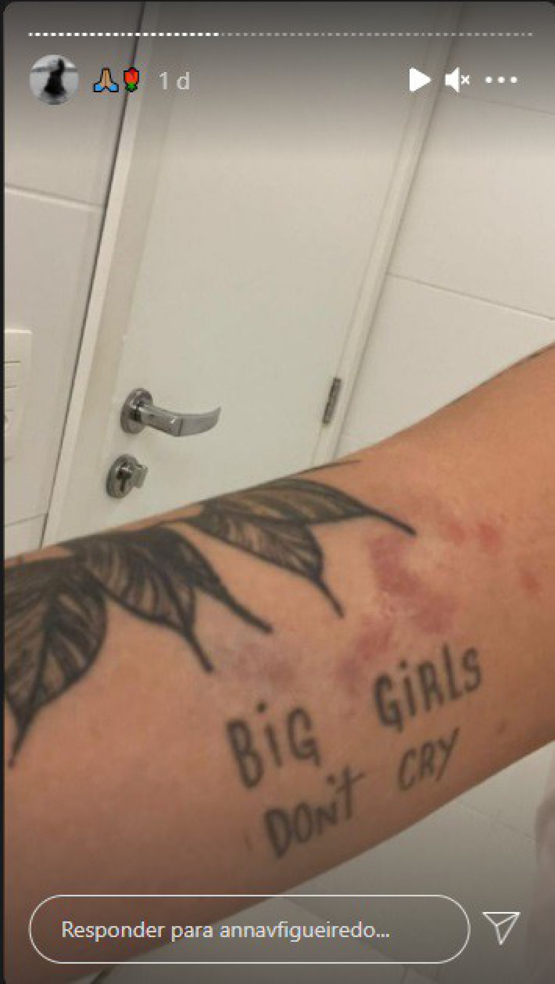 Modelo Anna Victória Figueiredo ficou com diversos hematomas após agressões - Reprodução