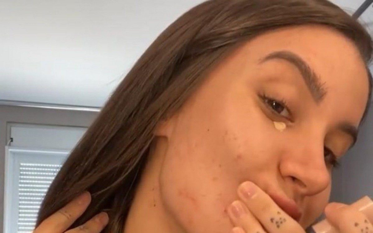 Bianca Andrade revela pele com acne ap&Atilde;&sup3;s nascimento de seu primeiro filho