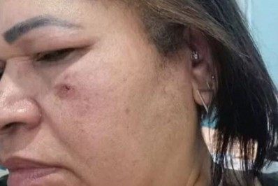 Confusão entre paciente e auxiliar de enfermagem em unidade de saúde acaba na delegacia