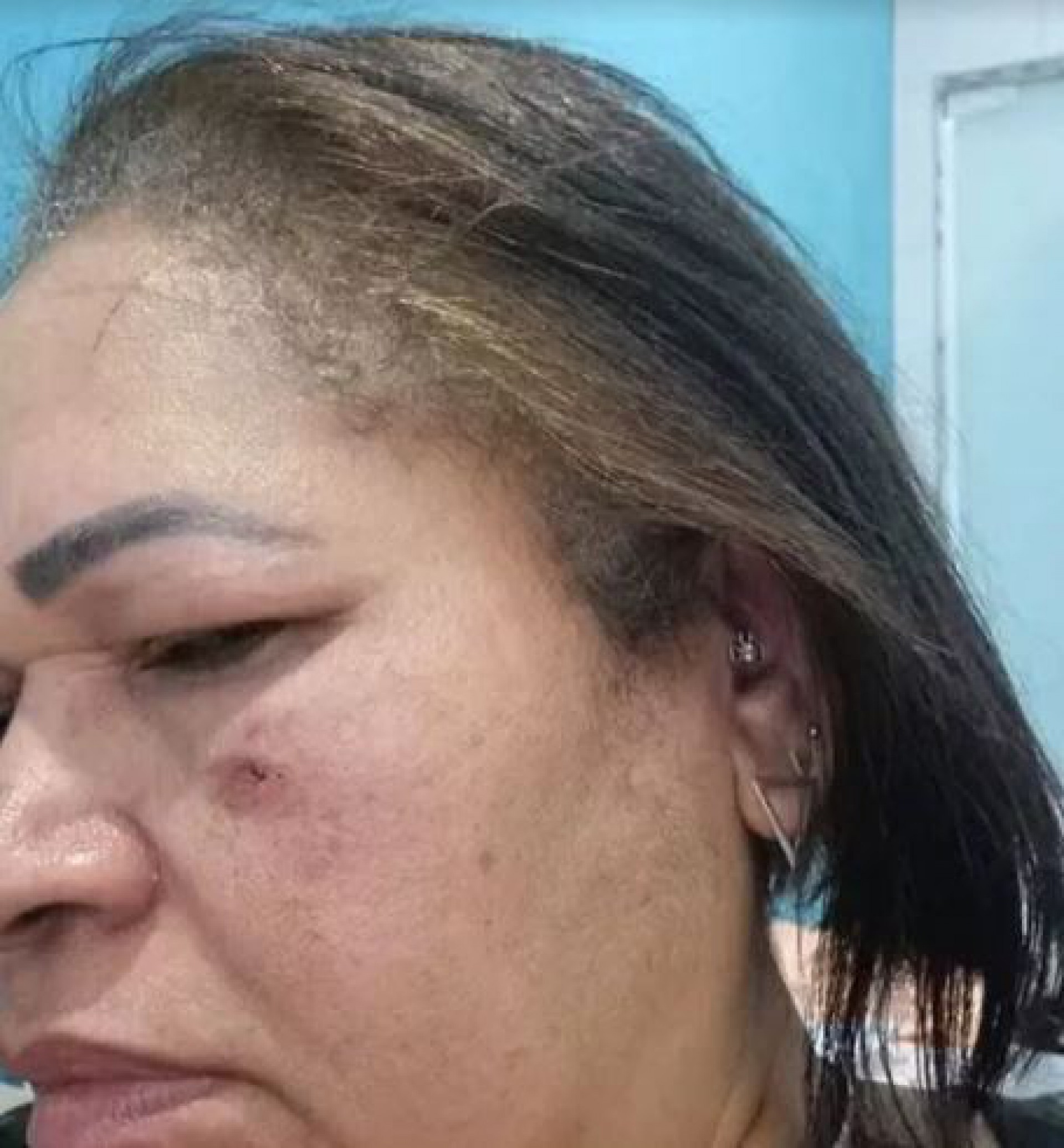 Confus&atilde;o entre paciente e auxiliar de enfermagem em unidade de sa&uacute;de acaba na delegacia