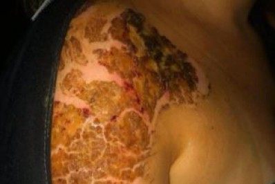 Policial militar denunciado por agressão em Campo Grande é afastado da corporação