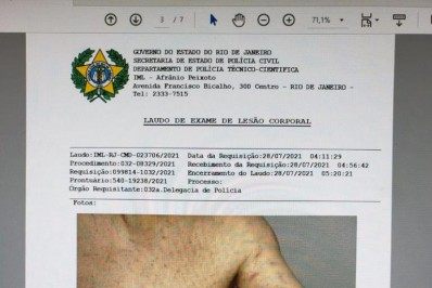 Ex de Marcela Peringer diz ter sido agredido pela atriz ao se defender de acusação de violência doméstica