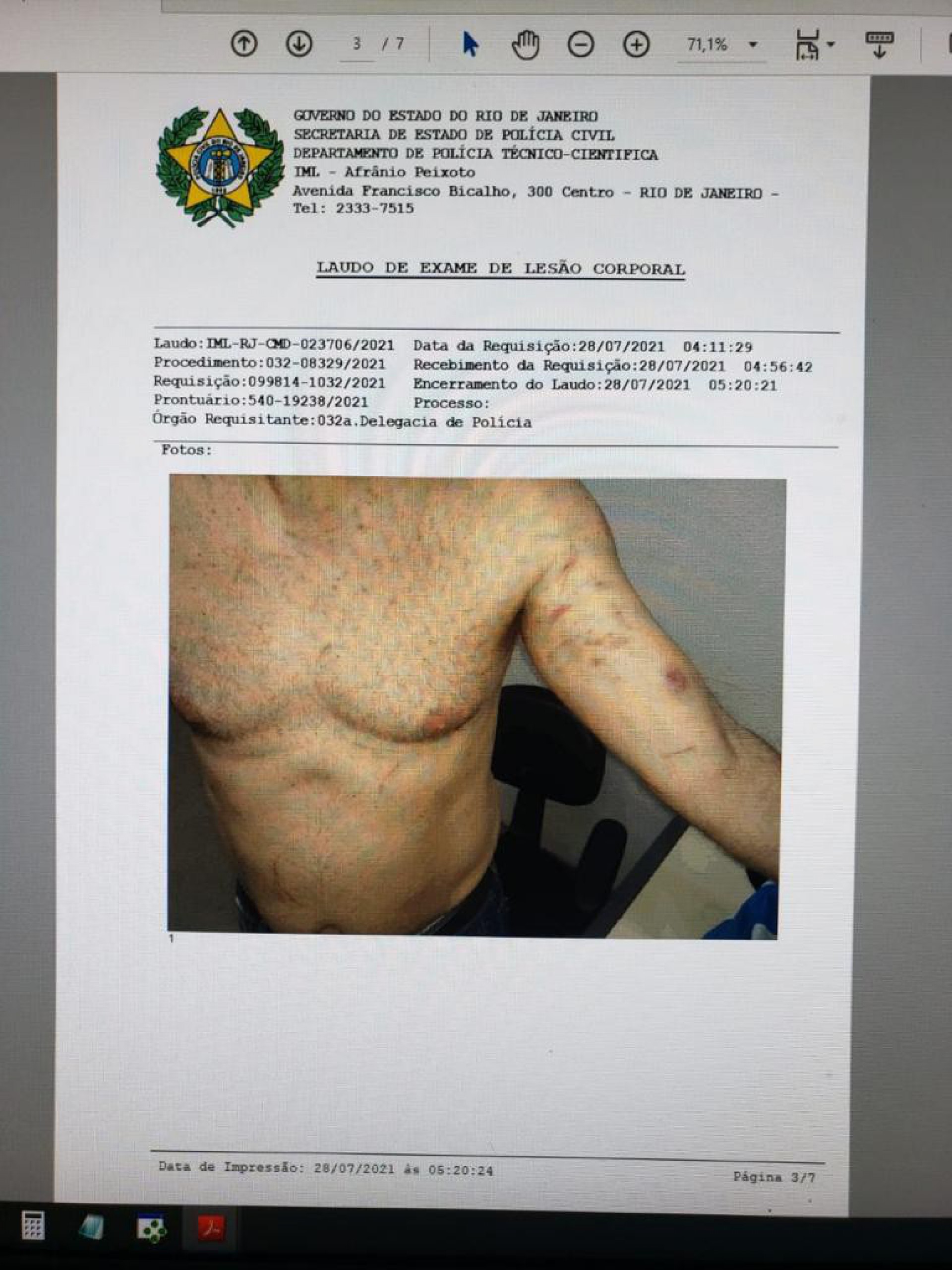 Ex de Marcela Peringer diz ter sido agredido pela atriz ao se defender de acusação de violência doméstica